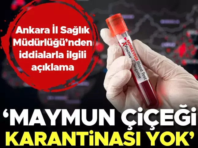 Ankara İl Sağlık Müdürlüğü’nden iddialara yalanlama: Mpox karantinası yok