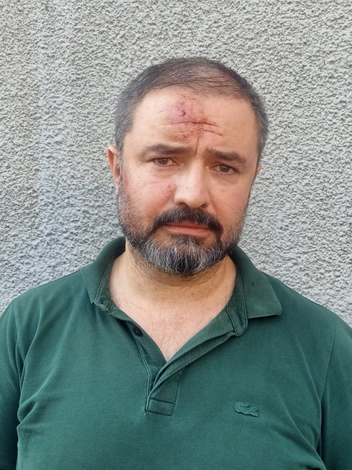 İcra avukatına meydan dayağı