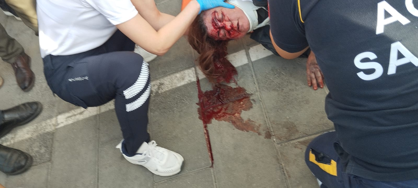 Çine’de feci kazada havaya savruldu: talihsiz Kadın ölümle pençeleşiyor!